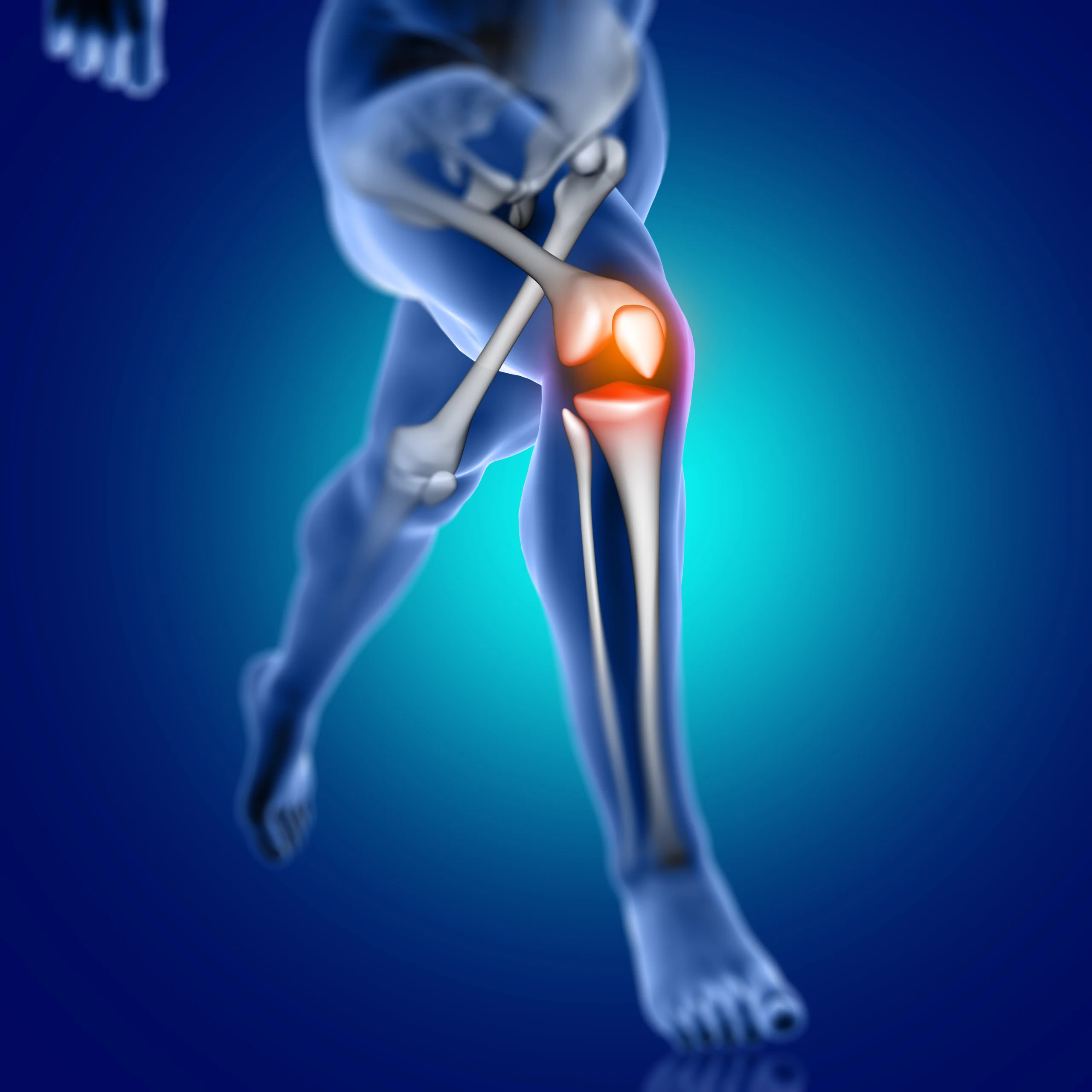 Knee Replacement Mistakes