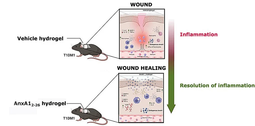 Diabetes patients' skin wound healing may be enhanced by an inexpensive anti-inflammatory hydrogel